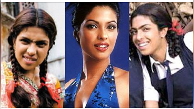 bollywood actress pictures after lip surgery