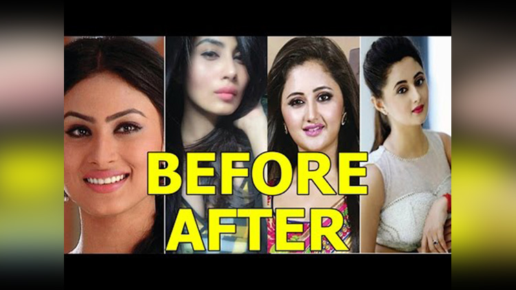 tv actresses before and after plastic surgery