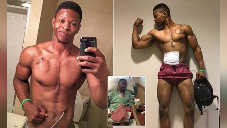Meet the fitness model using his scars and artificial heart to inspire people