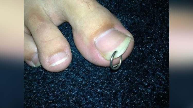 toe nail piercing