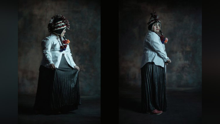 Fashion Photo Shoot Of Women With Down Syndrome Stunningly