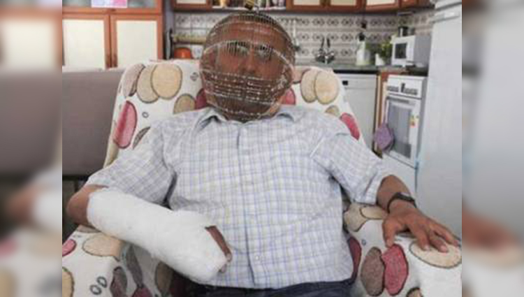 Turkish Guy Puts Cage On His Head To Quit Smoking
