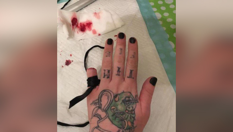 woman cut off her little finger