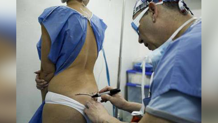 Dangerous butt implants ruining women's lives across Venezuela 