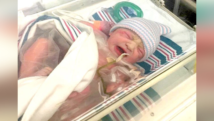 Infant Born with Organs Outside her Body goes Under Life-Saving Surgery 