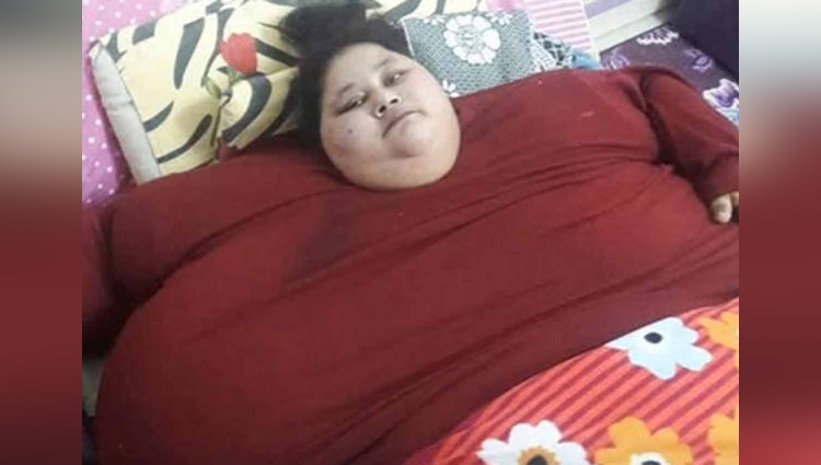 What! World's Heaviest Women Lost 100 Kg By A Surgery In Mumbai