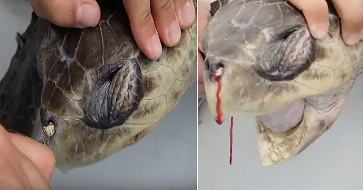 See What Was Clogged In The Nose Of This Sea, Turtle Found In Costa Rica