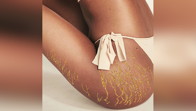 artist turns stretch marks into art in order to encourage people
