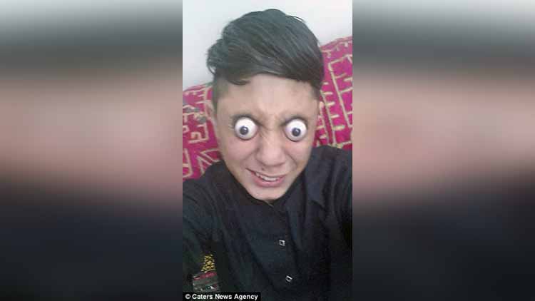 Oh Man! Is his Eyes Still in his Eye Sockets? DonтАЩt Dare to Try This Eye-Popping Stunt at Home...