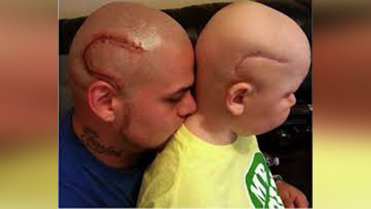 You gotta See This Best Bald Dad Whose Gesture for Son is Melting Everyone's Hearts! 