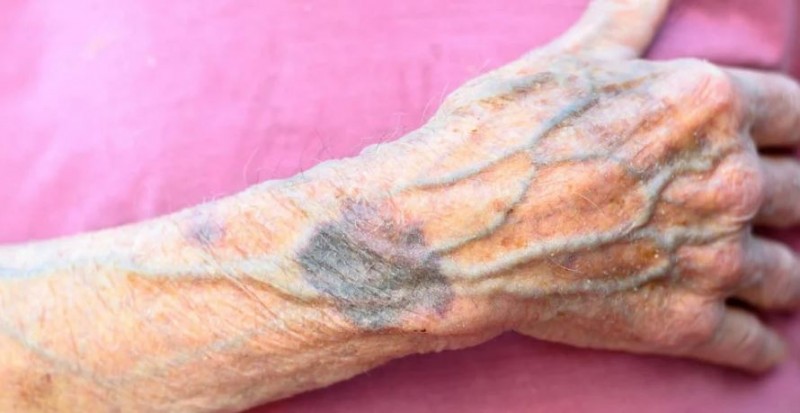 Why do our veins look blue know the science behind it