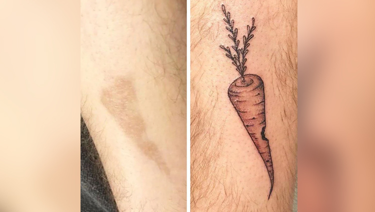 People Brilliantly Use Tattoos To Cover Their Birthmarks