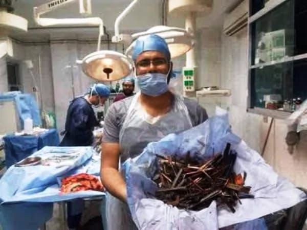 The woman was having pain in her stomach for several days, when the operation was done, the doctors were stunned.