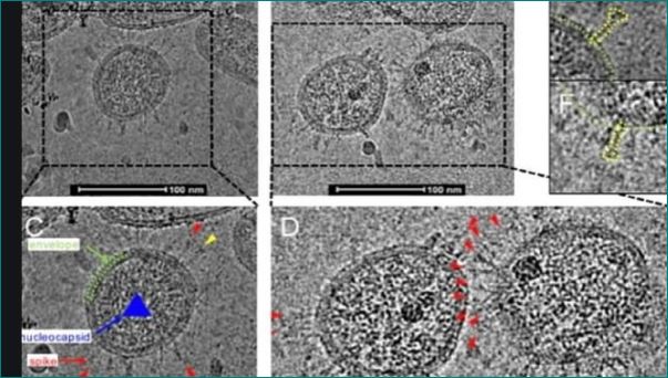  Researchers capture the first pictures showing the real appearance of new coronavirus in China 