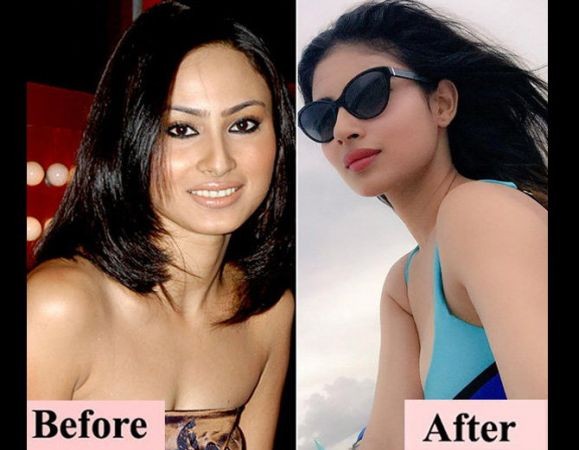 These actresses used to look like this before undergoing surgery