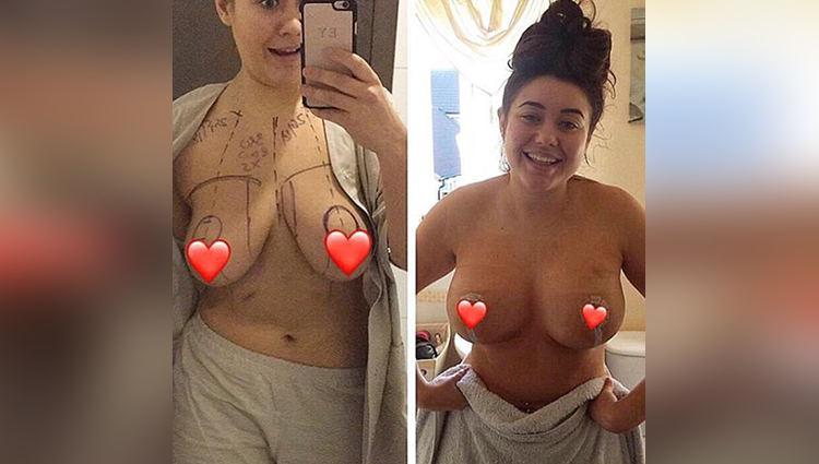 Big Brother 2017 star Ellie Young shows off the results of her boob job 
