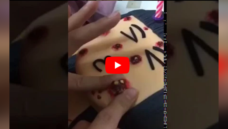 VIDEO Pimple popping cake has squeezable zits