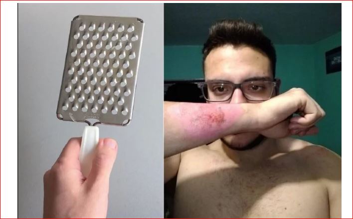 Man Removed His Tattoo By Using Grater People Shocked