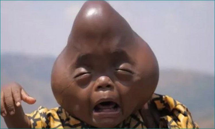 Child looking like an alien african country Rwanda